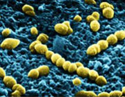 Neumococo, bacteria que provoca meningitis o neumonía