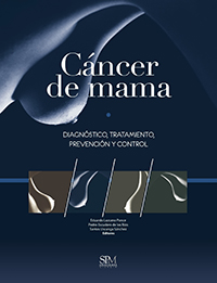 Cáncer de mama